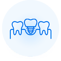 Протезирование зубов