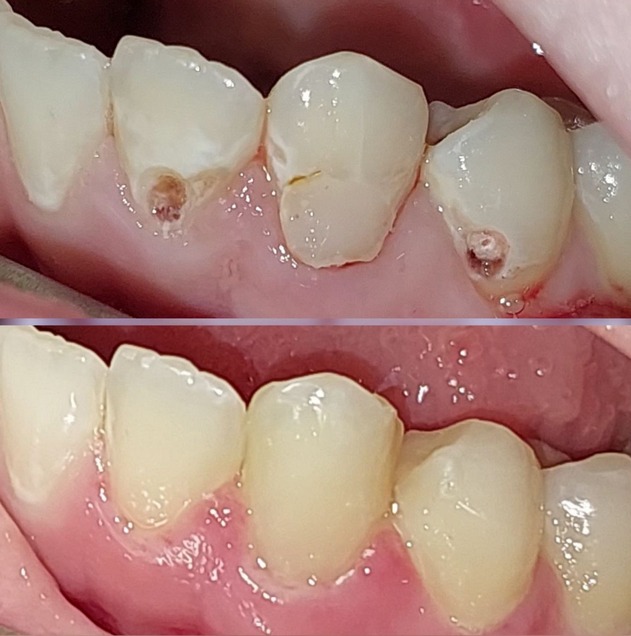 Лечение и протезирование