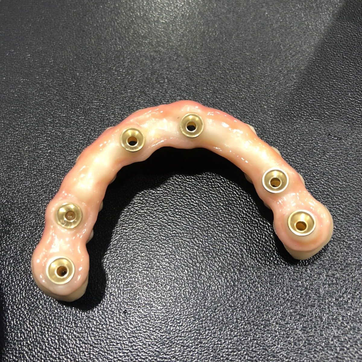 Дентальная имплантация