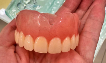 Памятка по уходу за съёмными протезами