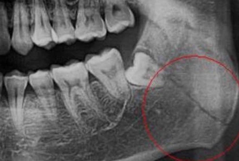 Зимние прогулки всегда приносят огромную радость не только детям, но и взрослым. Но и в зимнее время следует не забывать о безопасности!