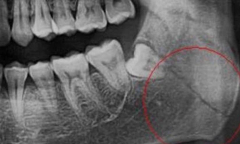 Зимние прогулки всегда приносят огромную радость не только детям, но и взрослым. Но и в зимнее время следует не забывать о безопасности!